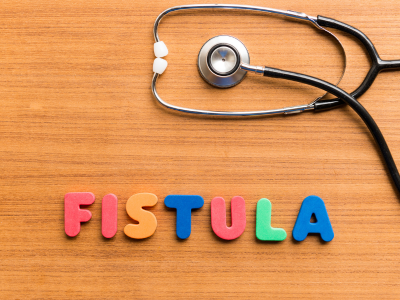 Fistula Treatment in Ghaziabad